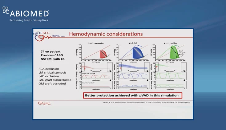 JESFC Congress 2021: ABIOMED Symposia Recording

&nbsp;
