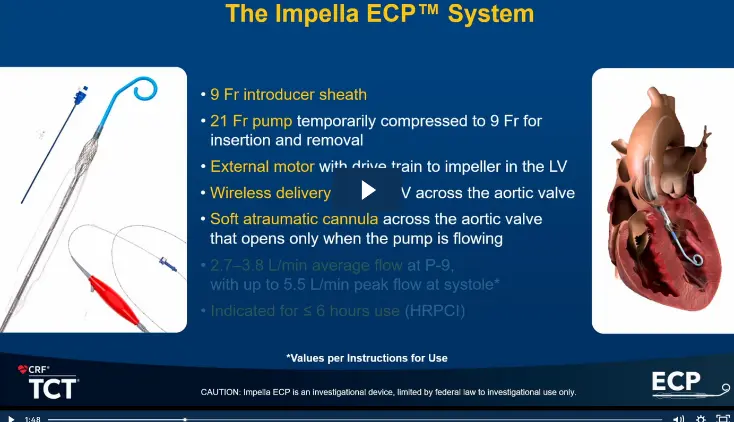 Impella ECP<sup>™</sup> Pivotal Study: First Results