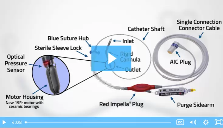 Impella 5.5® with SmartAssist® Tip-to-Toe
