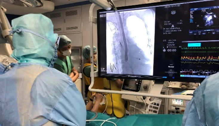 Behandlung des ersten Patienten mit der Impella 5.5 mit SmartAssist Herzpumpe in Japan Blog Image
