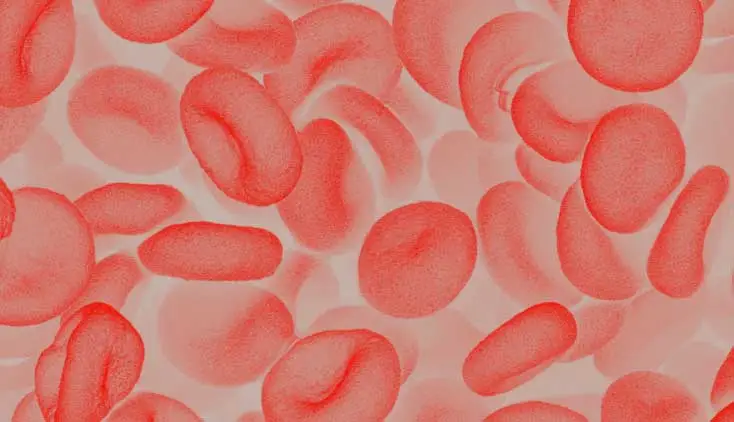 Hemodynamic and Physiologic Assessment of the Cardiogenic Shock Patient Self-Directed Training