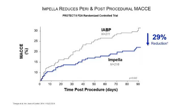 Clinical Data Highlights Advantages of Protected PCI to Enable Complete Revascularization and Improved Patient Quality of Life Press Release Image