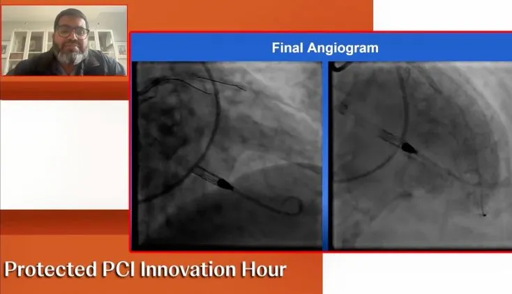 Protected PCI Innovation Hour (On‑Demand) with Mir Babar Basir, DO