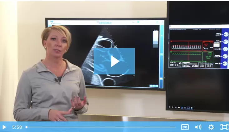Managing Impella® Position Using Imaging and the Automated Impella Controller™
