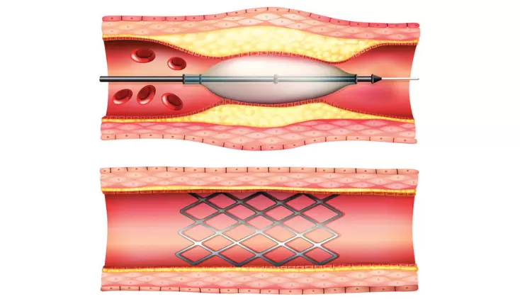 PCI vs. Protected PCI: Was ist der Unterschied und welche ist die Richtige für mich? Blog Image