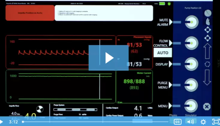 Using the LV Waveform to Troubleshoot Suction Events
