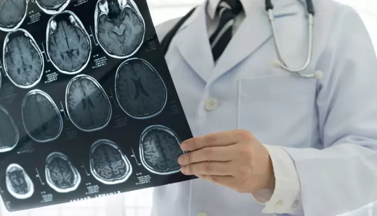 Know the Signs of Stroke and How to Protect Your Heart Blog Image