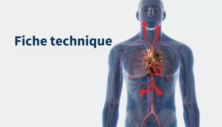 Centre-de-Ressources/Impella CP® avec SmartAssist® Fiche technique teaser image