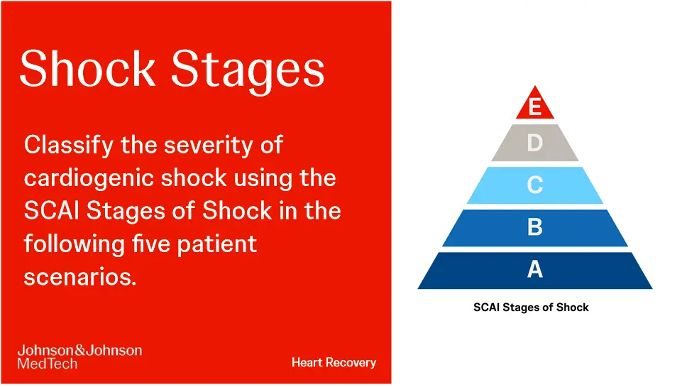 SCAI stage classification of CS