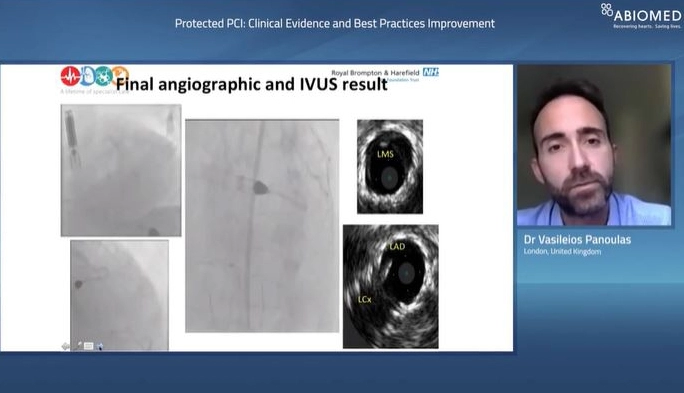 Dr. med. Vasileios Panoulas: Wiederherstellung der EF in der täglichen klinischen Praxis
