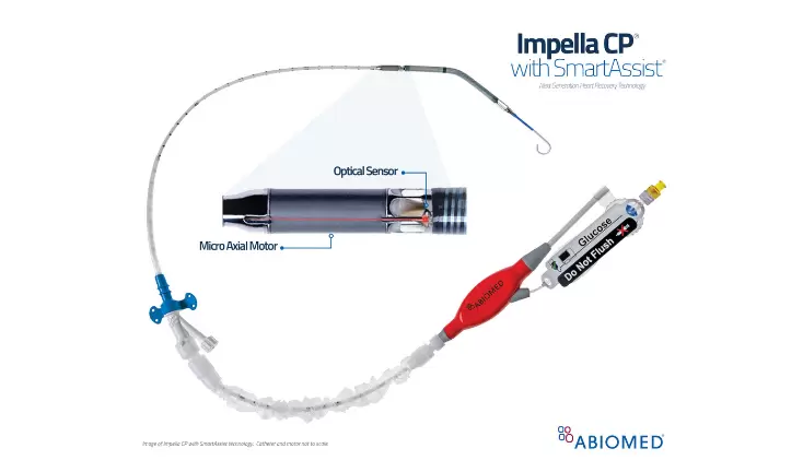 Impella SmartAssist Platform Launches at SCAI, Designed to Further Improve Patient Outcomes Press Release Image