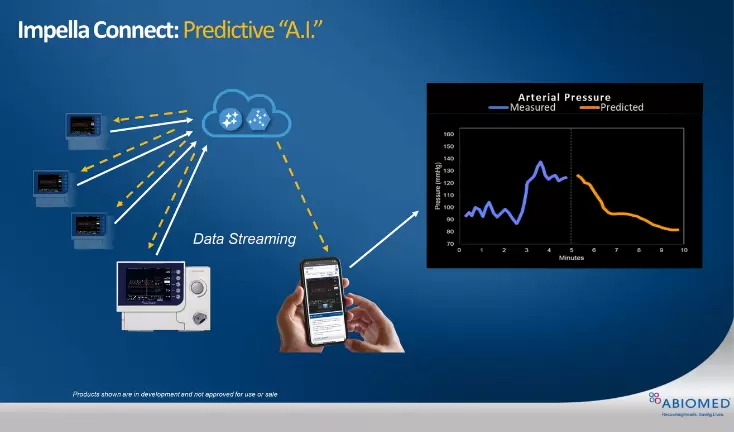 FDA Approves Data Streaming from the Impella Console, Setting the Stage for Artificial Intelligence Algorithms to Further Improve Patient Outcomes Press Release Image
