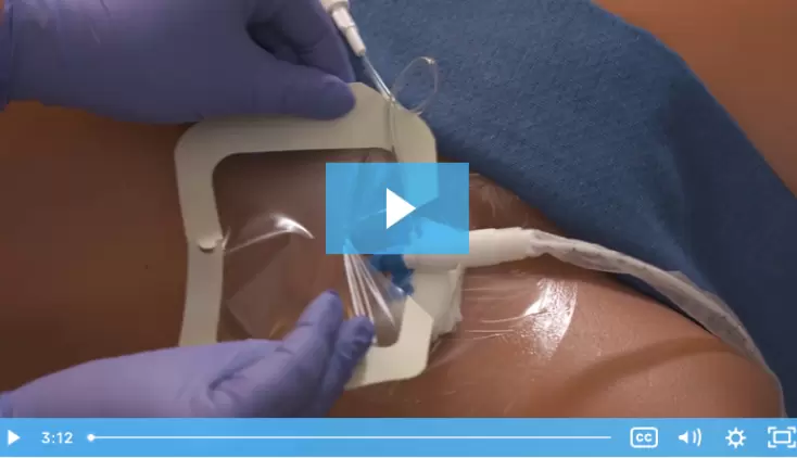 Assessing and Maintaining the Impella® Access Site
