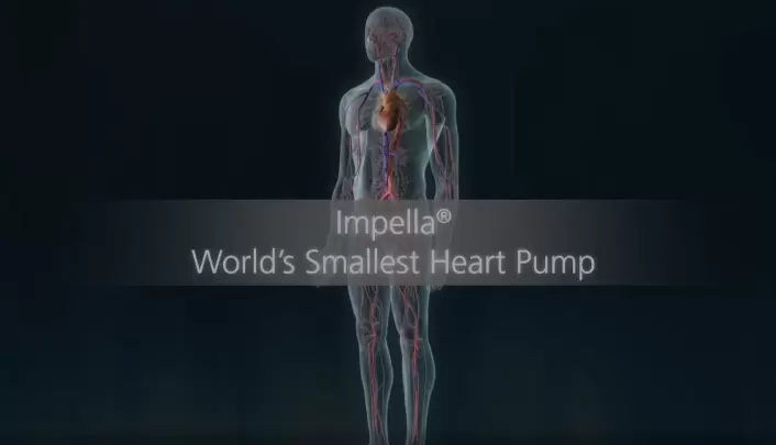 Animation - Impella 2.5 / Impella CP media custom image